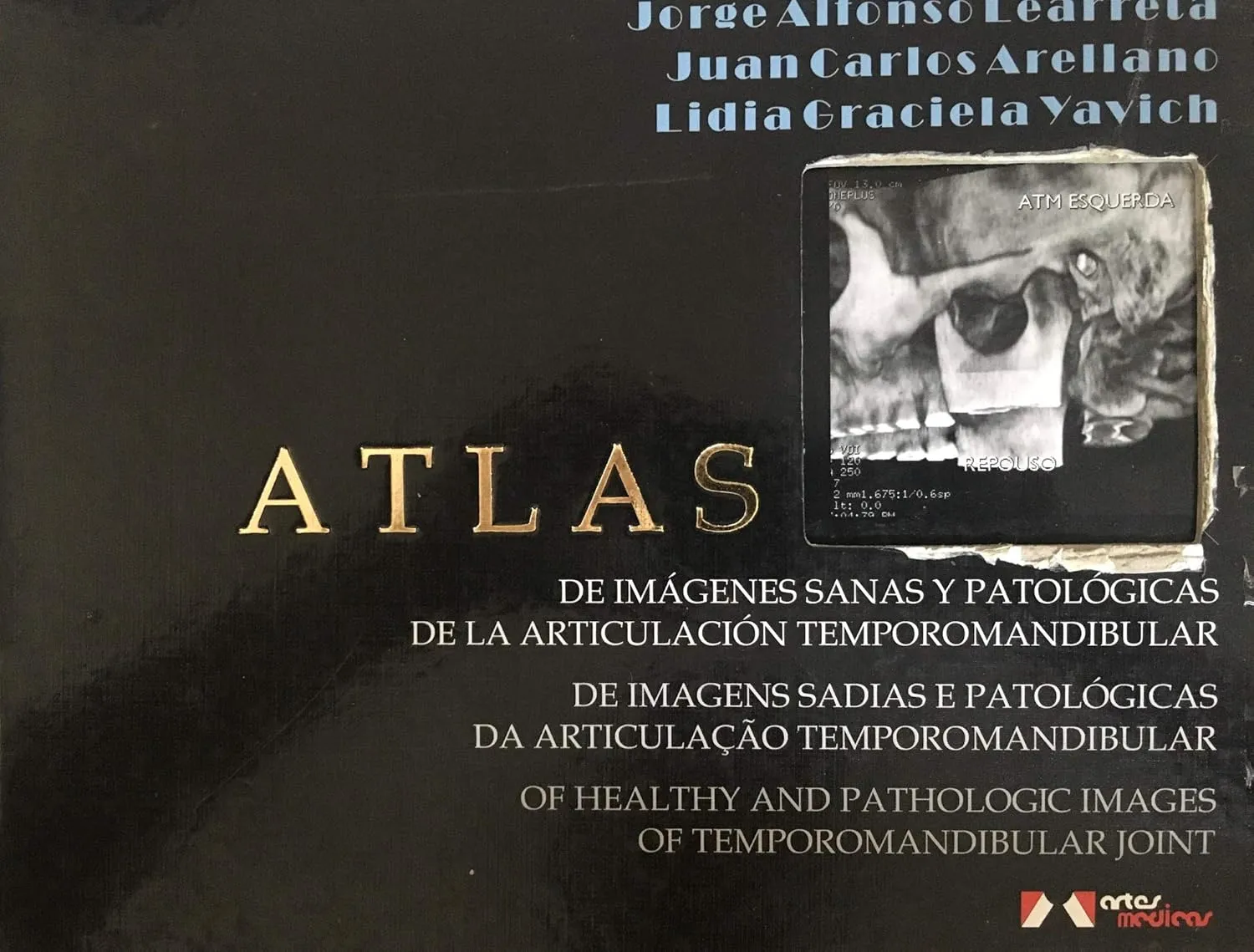 Atlas of Health and Pathologic Images of Temporomandibular Joint | Hardcover