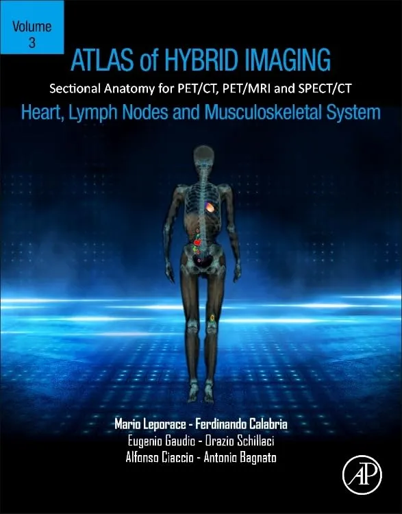 Atlas Of Hybrid Imaging Sectional Anatomy For Pet Ct Pet Mri And Spect Ct Heart Lymph Node And Musculoskeletal System Volume 3 | Paperback