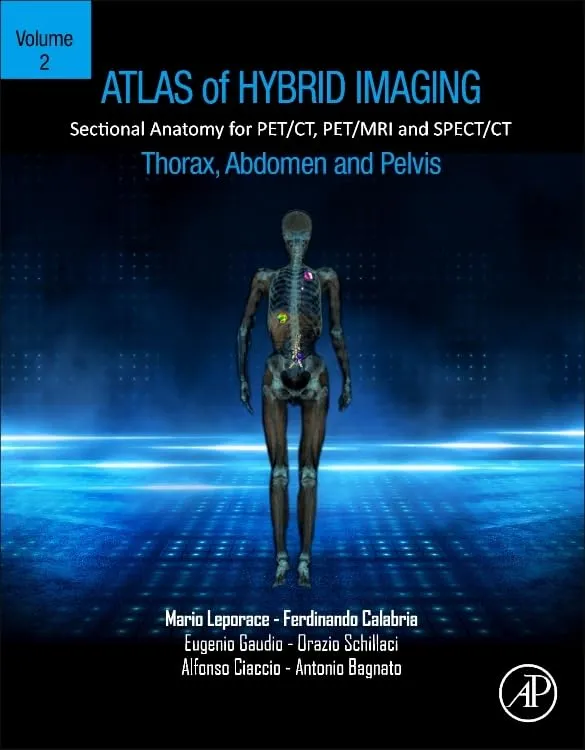 Atlas Of Hybrid Imaging Sectional Anatomy For Pet Ct Pet Mri And Spect Ct Thorax Abdomen And Pelvis Volume 2 | Paperback