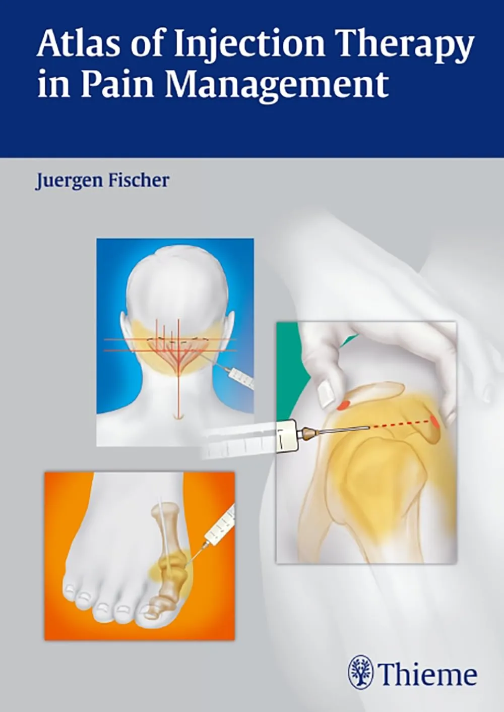Atlas of Injection Therapy in Pain Management | Hardcover