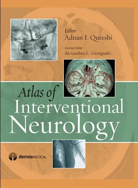 Atlas of Interventional Neurology | Hardcover
