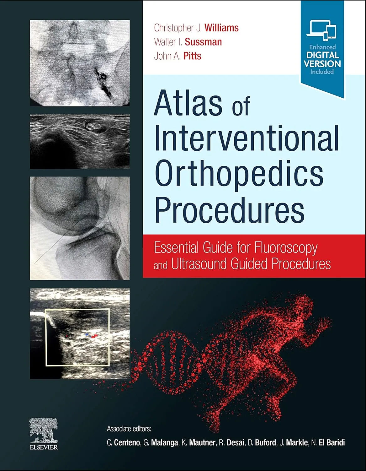 Atlas Of Interventional Orthopedics Procedures With Access Code | Hardcover
