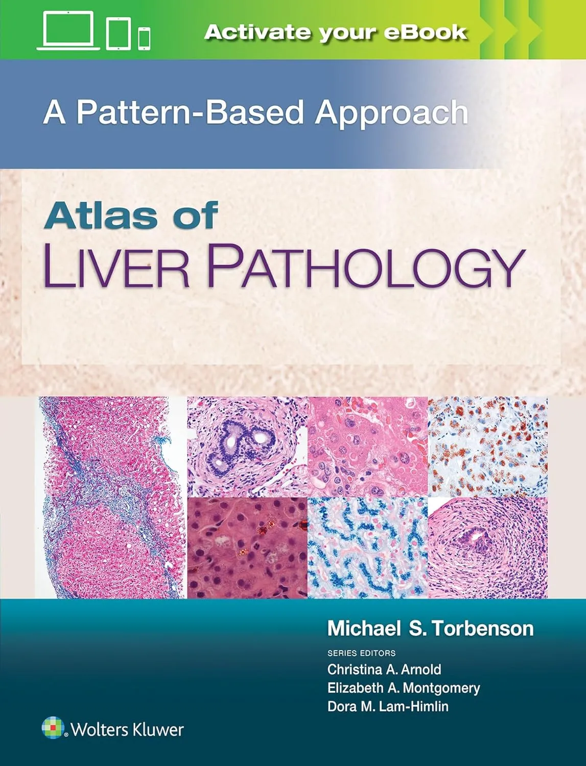 Atlas of Liver Pathology A Pattern-Based Approach | Hardcover