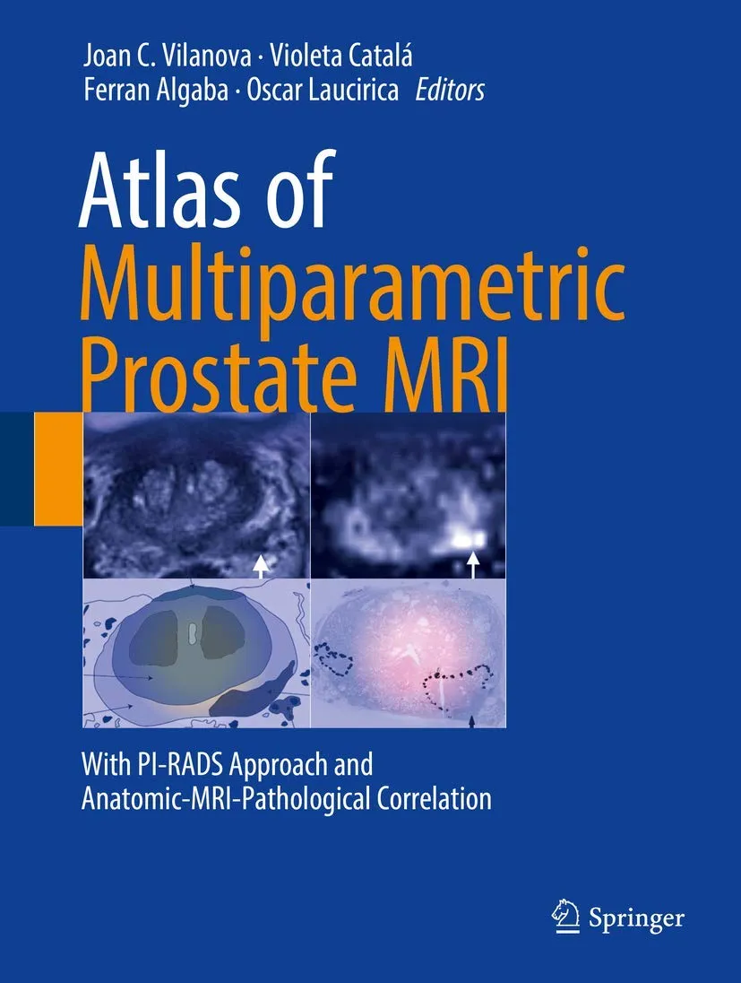 Atlas of Multiparametric Prostate MRI | Hardcover