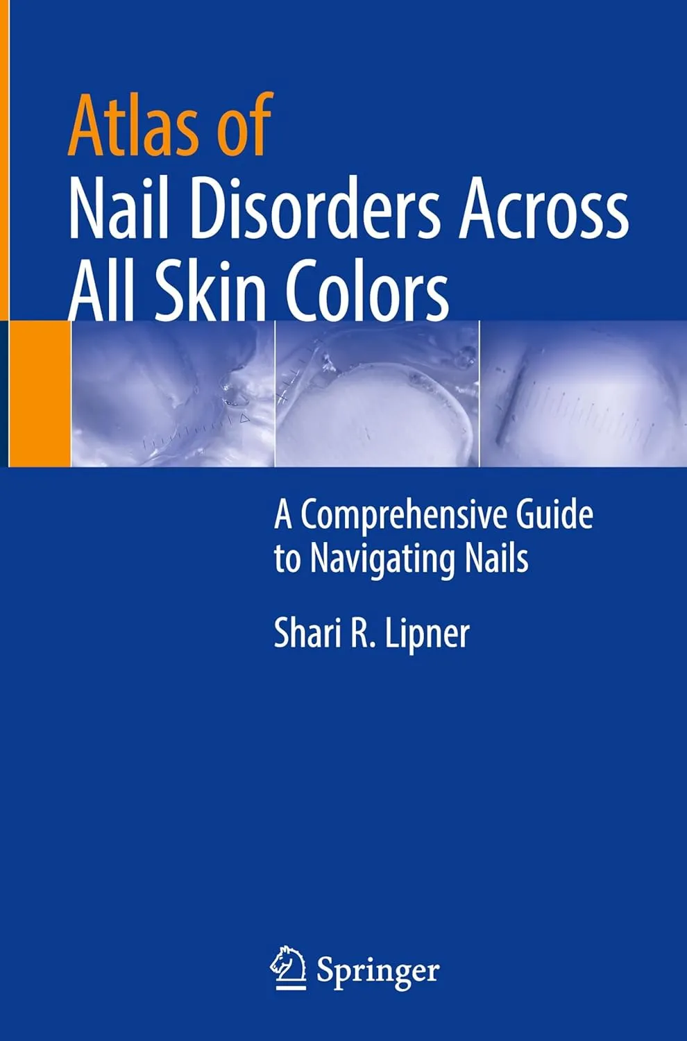 Atlas Of Nail Disorders Across All Skin Colors A Comprehensive Guide To Navigating Nails | Hardcover