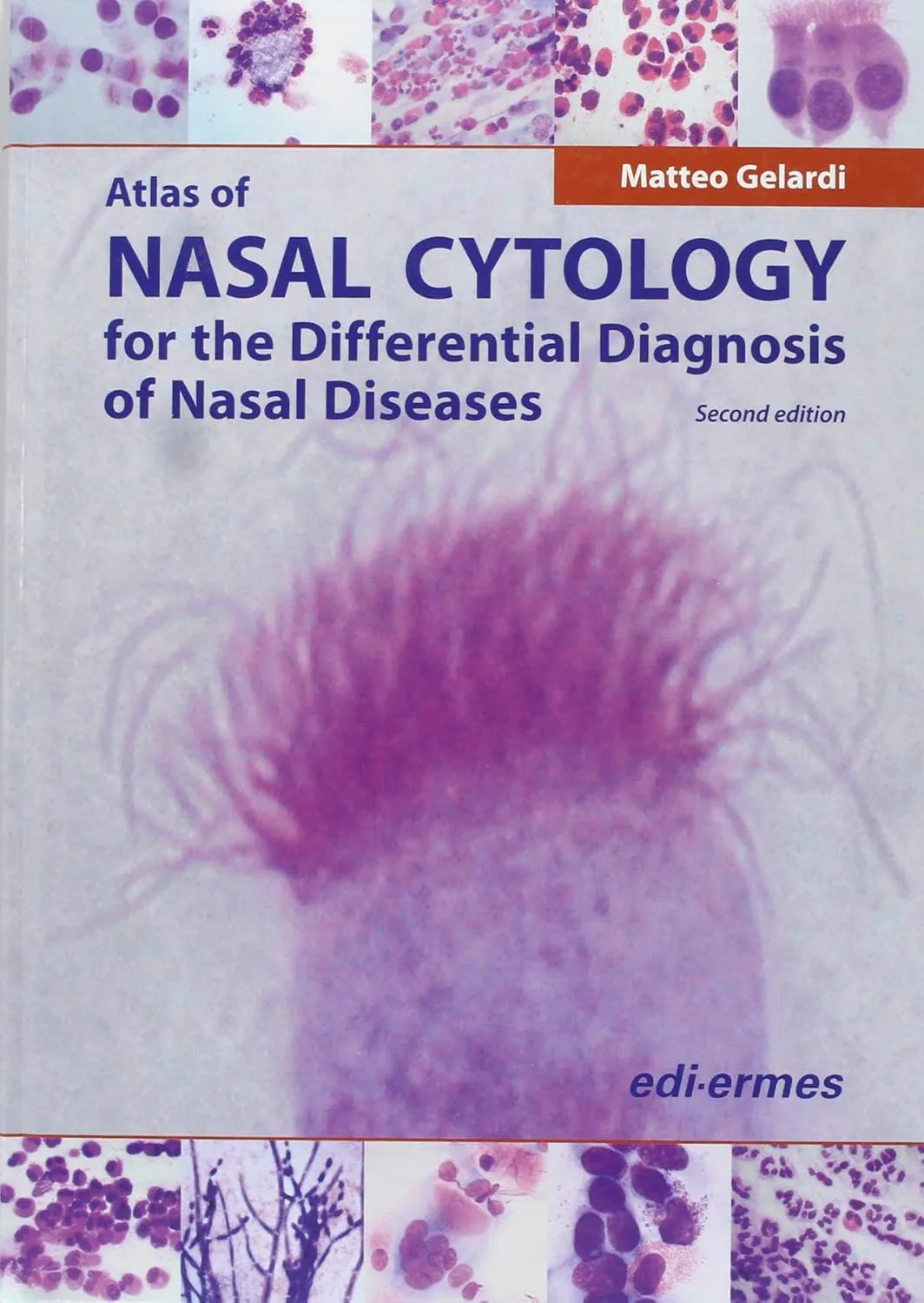 Atlas of Nasal Cytology for the Differential Diagnosis of Nasal Diseases | 2nd Edition | Hardcover
