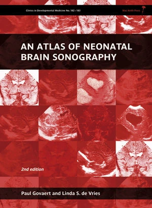 An Atlas of Neonatal Brain Sonography | 2nd Edition | Hardcover