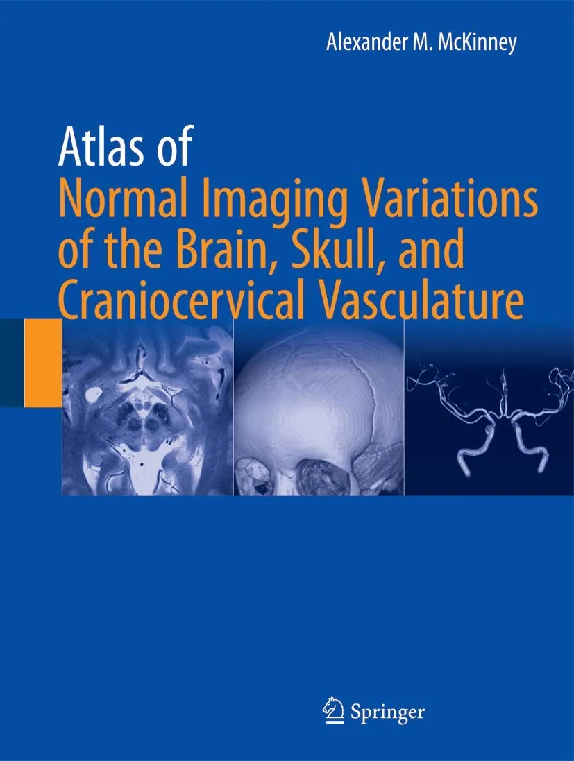 Atlas of Normal Imaging Variations of the Brain | Skull | and Craniocervical Vasculature | 2 Volume Set | Hardcover