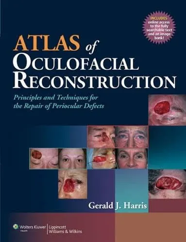 Atlas of Oculofacial Reconstruction Principles and Techniques for the Repair of Periocular Defects | Hardcover