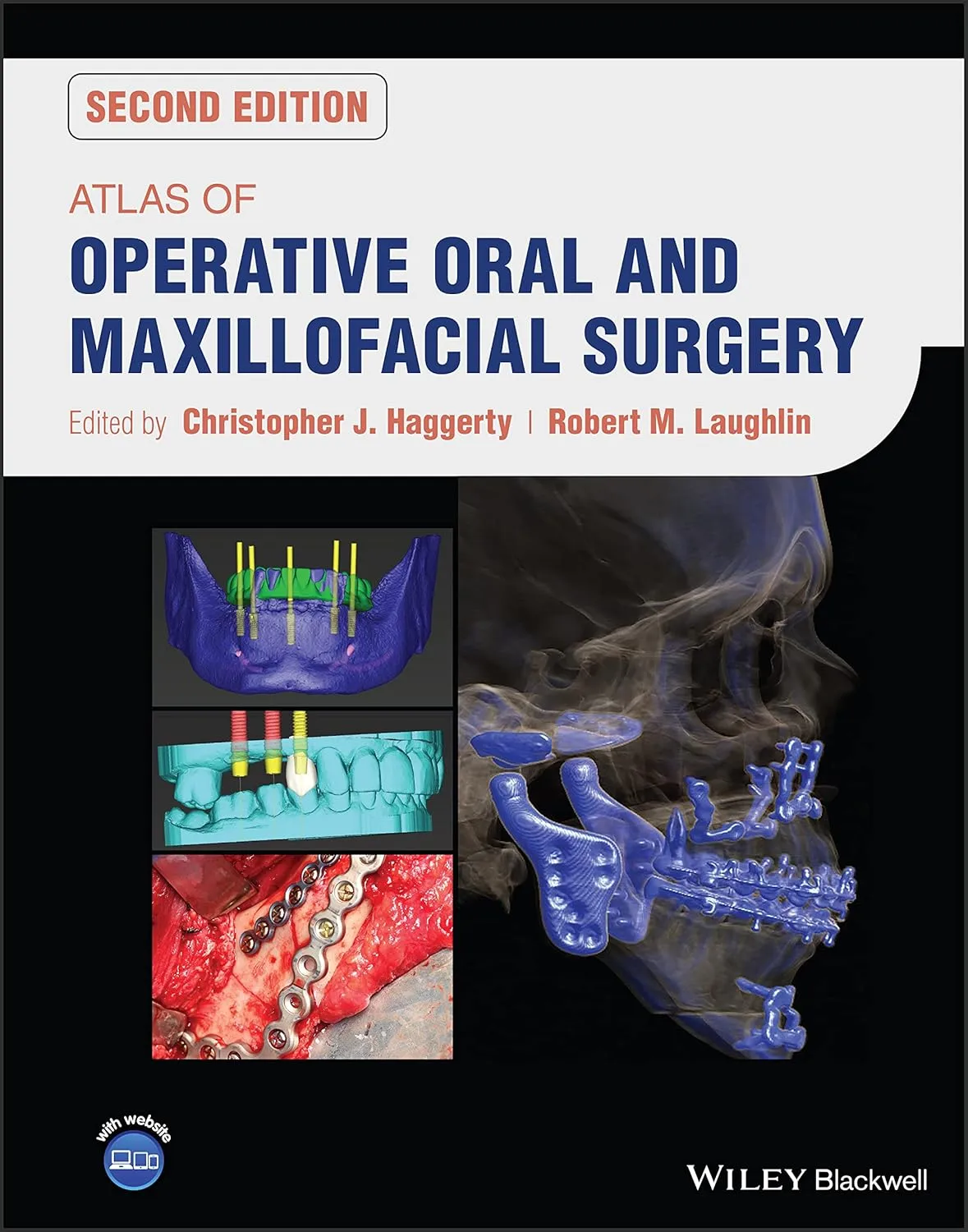 Atlas Of Operative Oral And Maxillofacial Surgery 2nd Edition | Hardcover