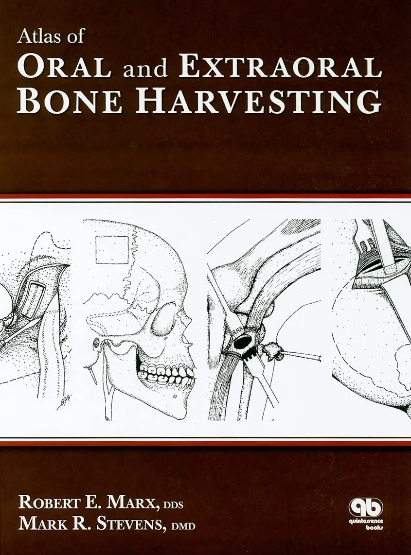 Atlas of Oral and Extraoral Bone Harvesting | Hardcover