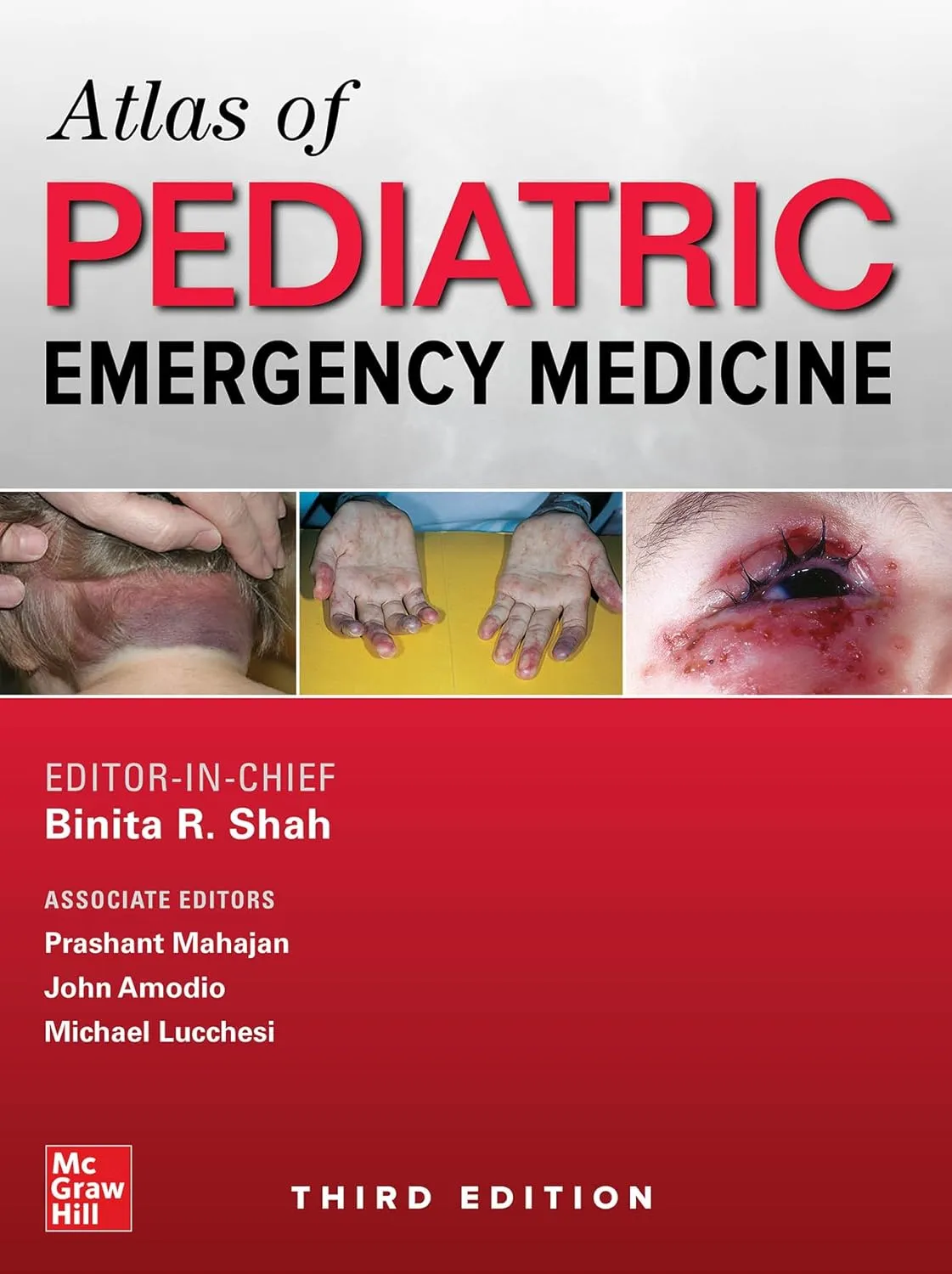 Atlas Of Pediatric Emergency Medicine Third Edition | Hardcover