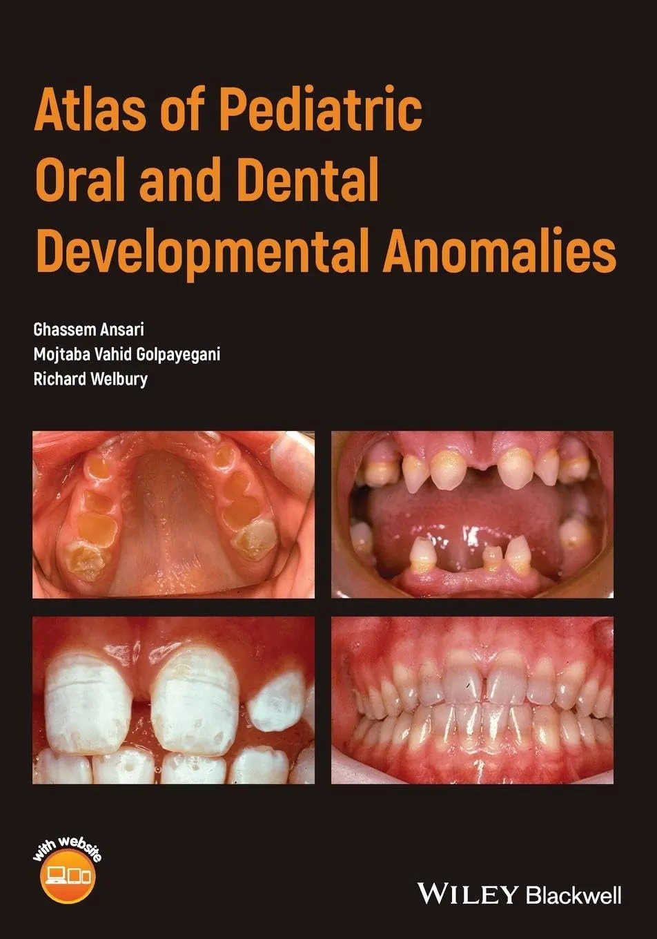 Atlas of Pediatric Oral and Dental Developmental Anomalies | Paperback