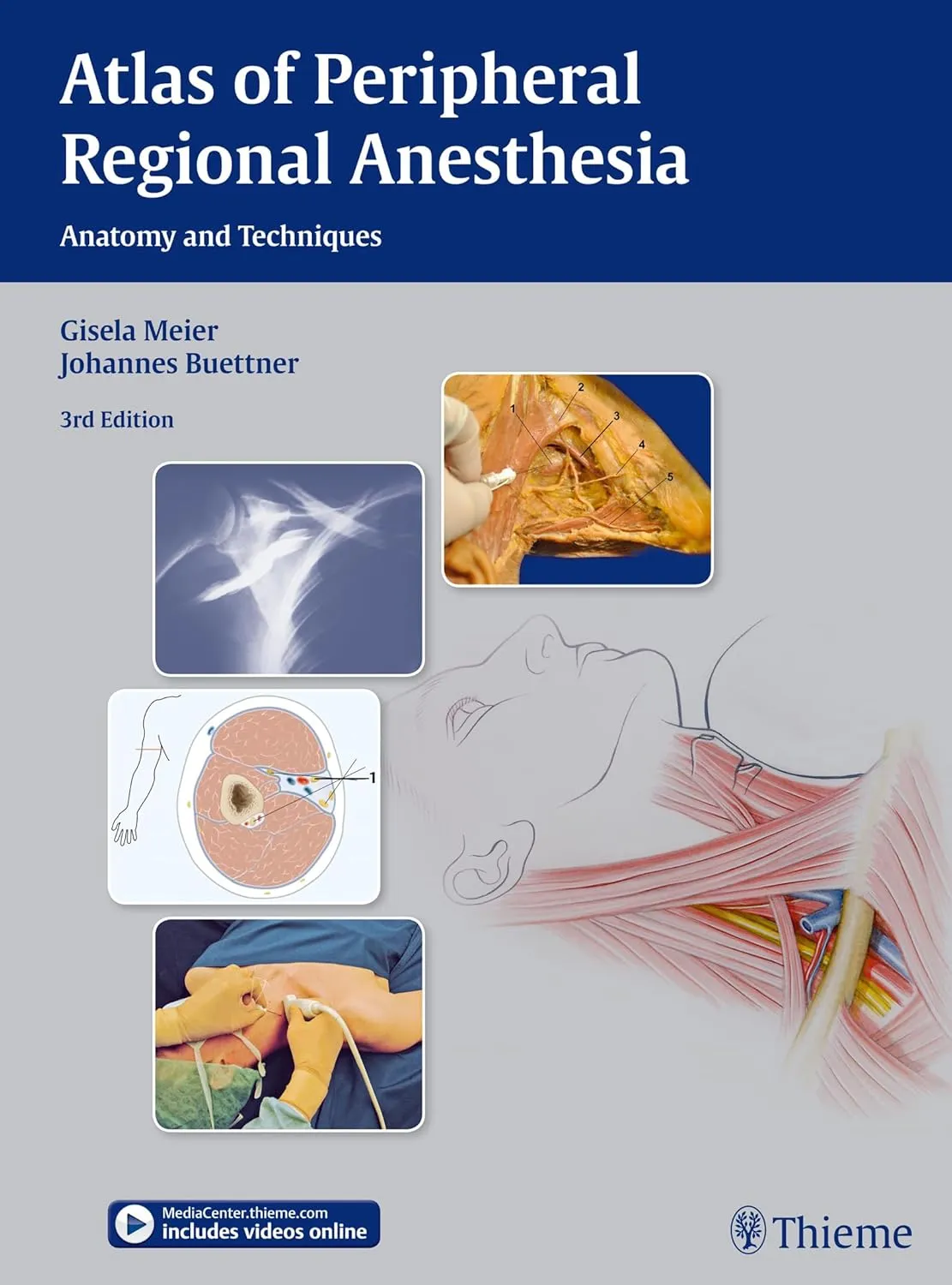 Atlas of Periopheral Regional Anesthesia Anatomy and Techniques | Third Edition | Hardcover