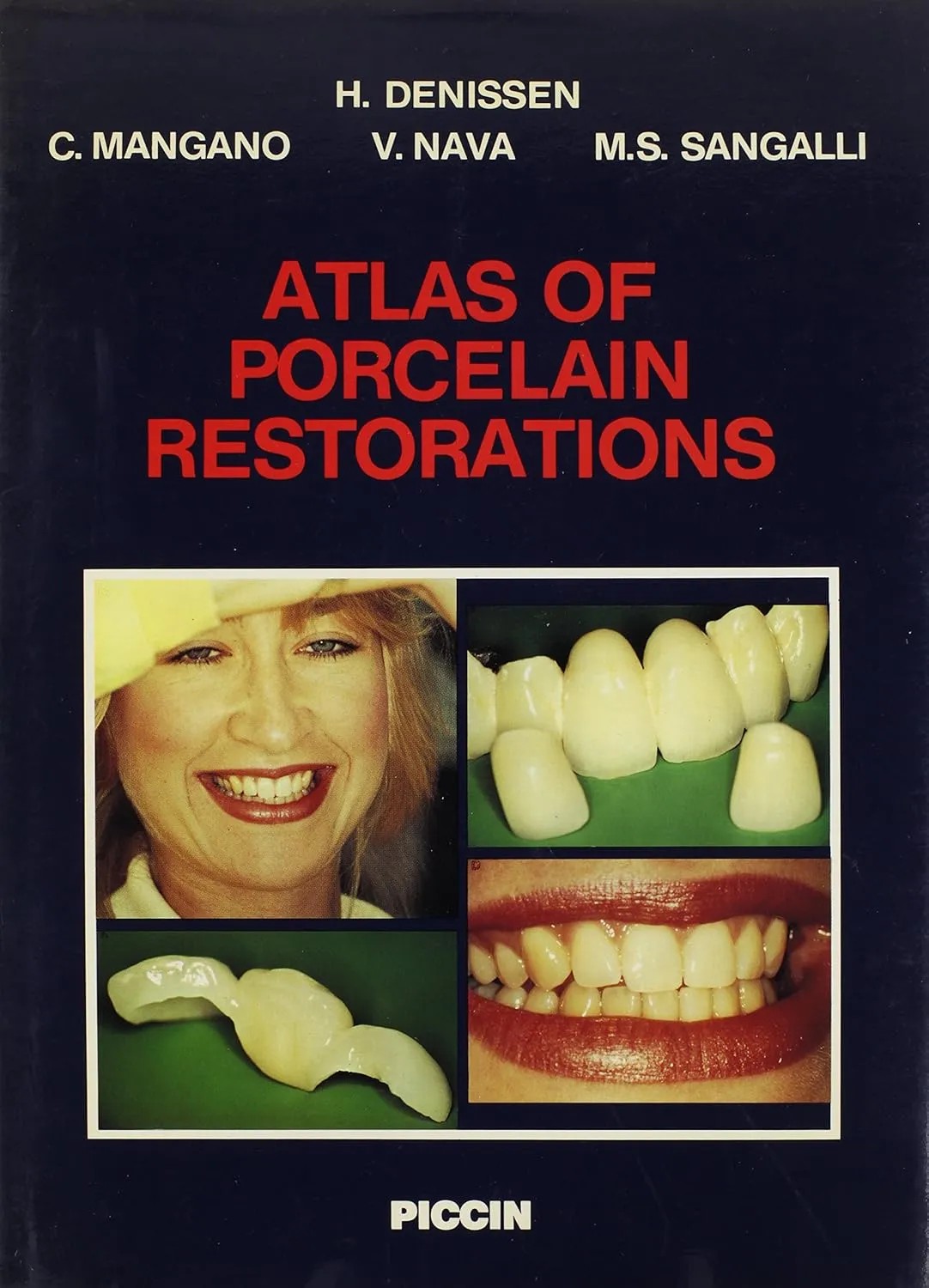 Atlas of Proclain Restorations