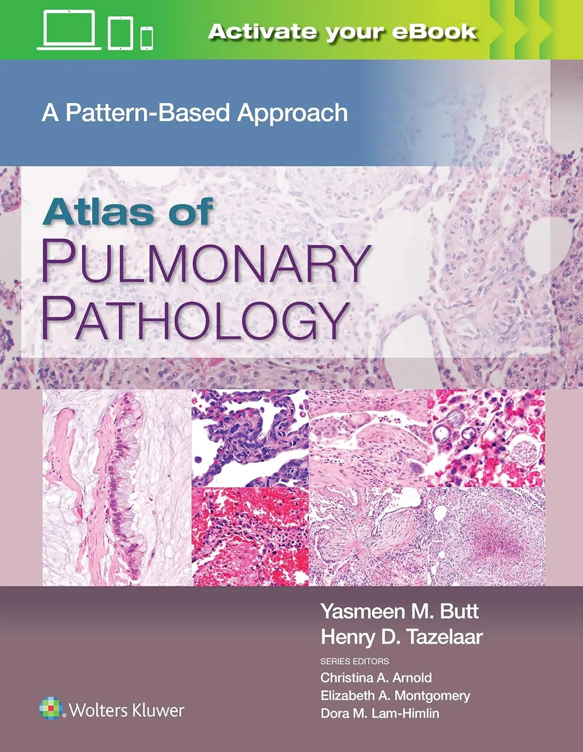 Atlas Of Pulmonary Pathology A Pattern Based Approach | Hardcover