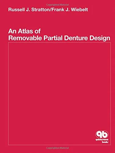An Atlas of Removable Partial Denture Design | Hardcover