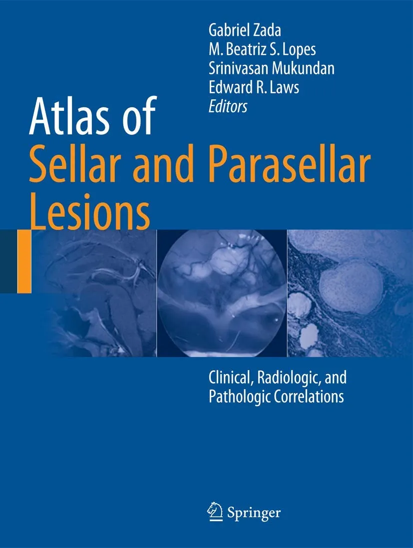 Atlas of Sellar and Parasellar Lesions | Hardcover