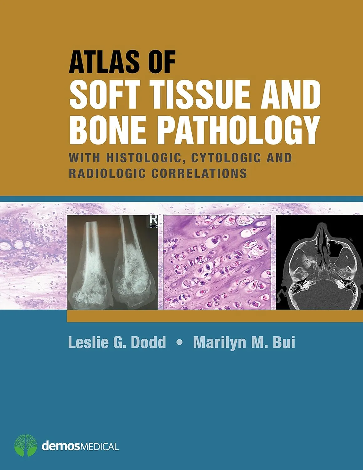 Atlas of Soft Tissue and Bone Pathology | Hardcover