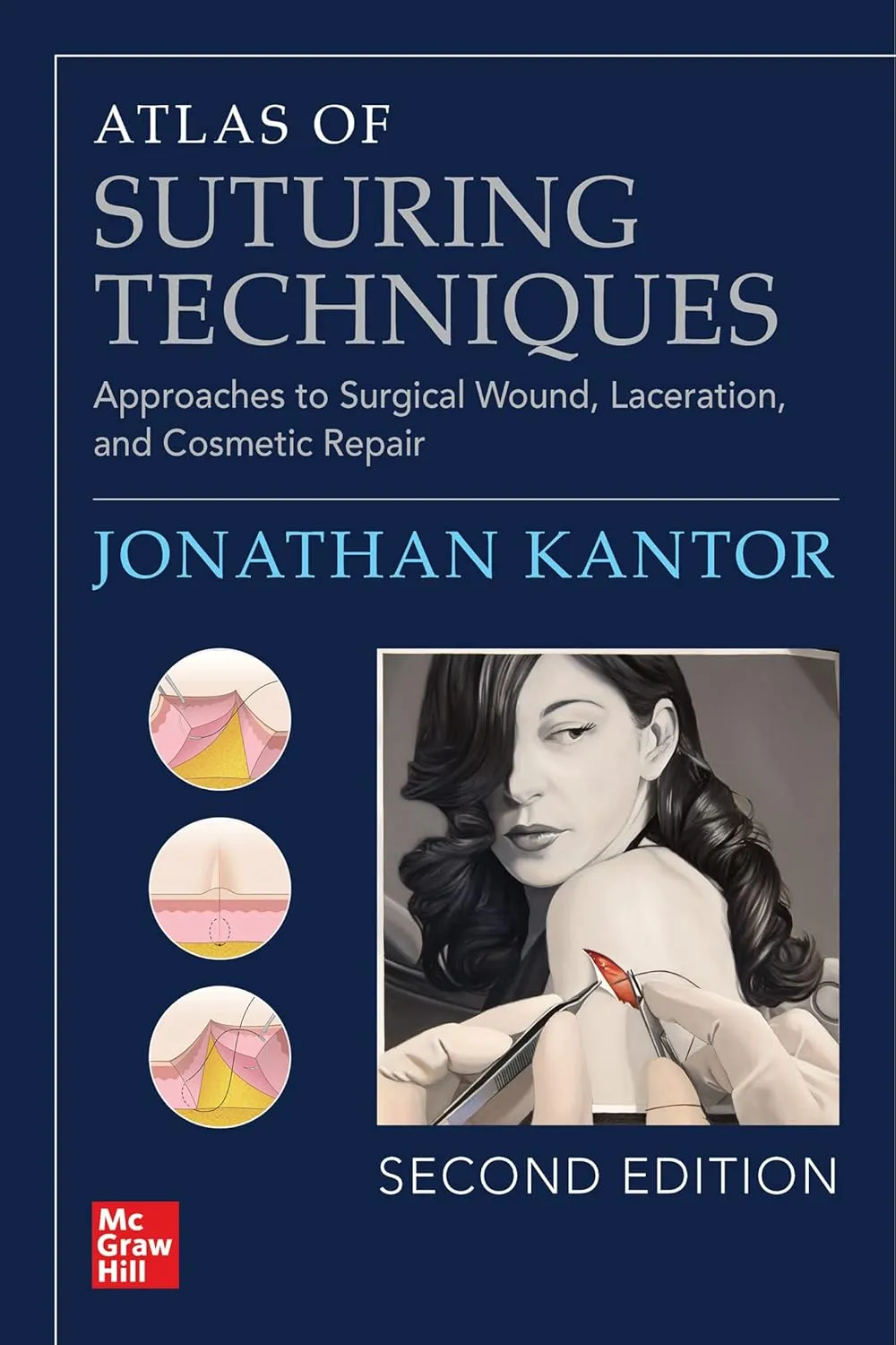 Atlas Of Suturing Techniques Approaches To Surgical Wound Laceration And Cosmetic Repair 2nd Edition | Paperback