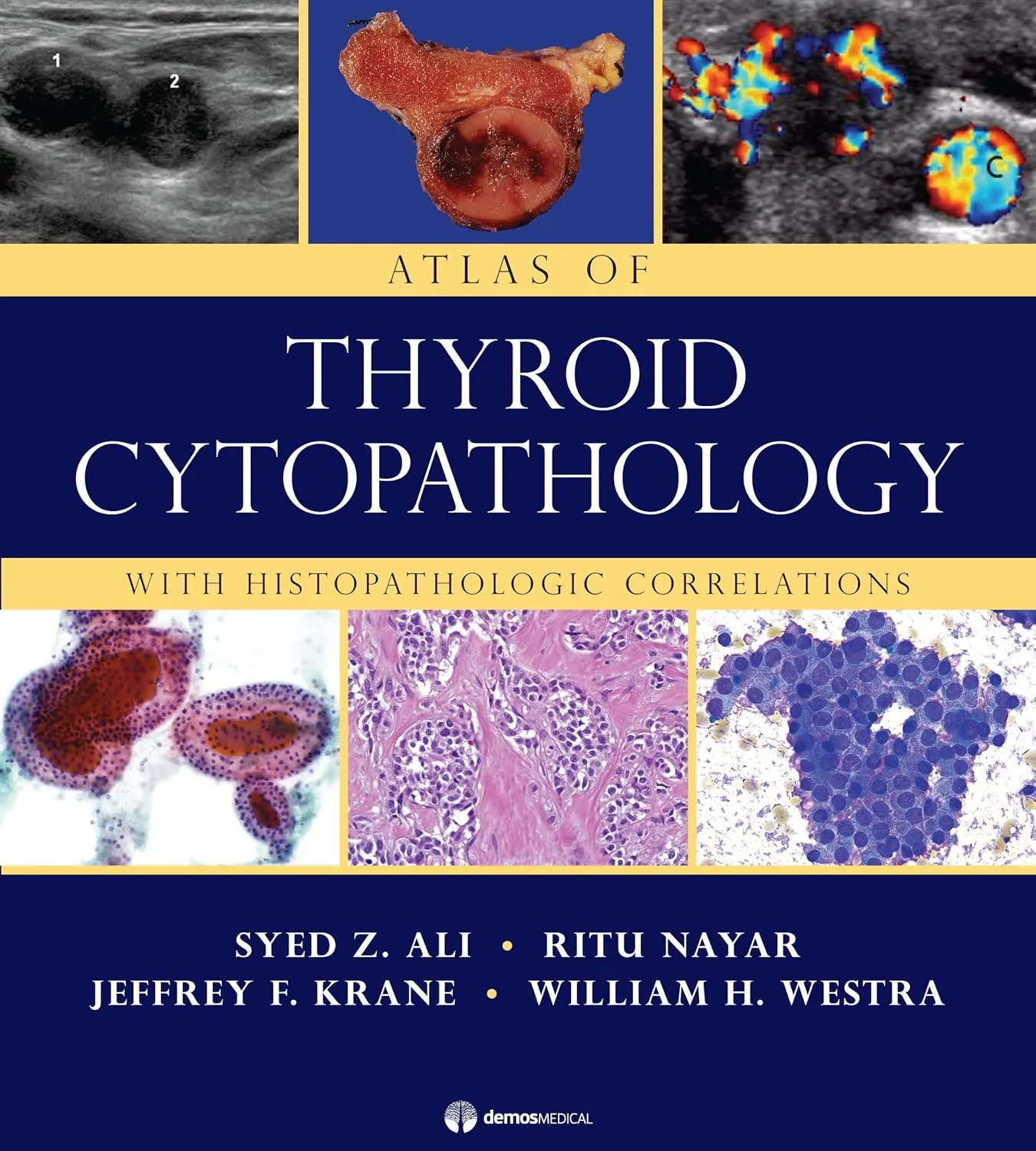 Atlas of Thyroid Cytopathology With Histopathologic Correlations | Hardcover