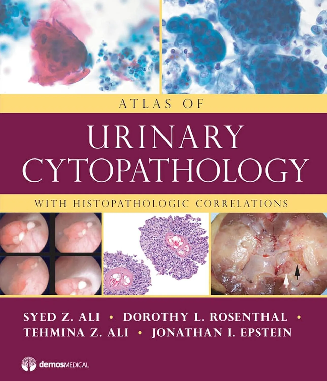 Atlas of Urinary Cytopathology With Histopathologic Correlations | Hardcover