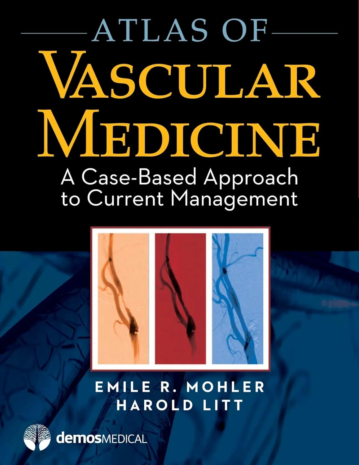 Atlas of Vascular Medicine A Case-Based Approach to Current Management | Hardcover