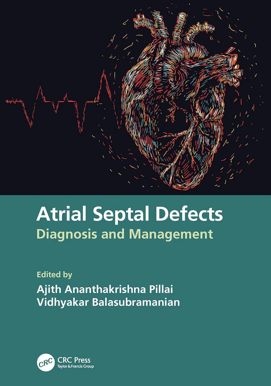 Atrial Septal Defects Diagnosis And Management | Paperback