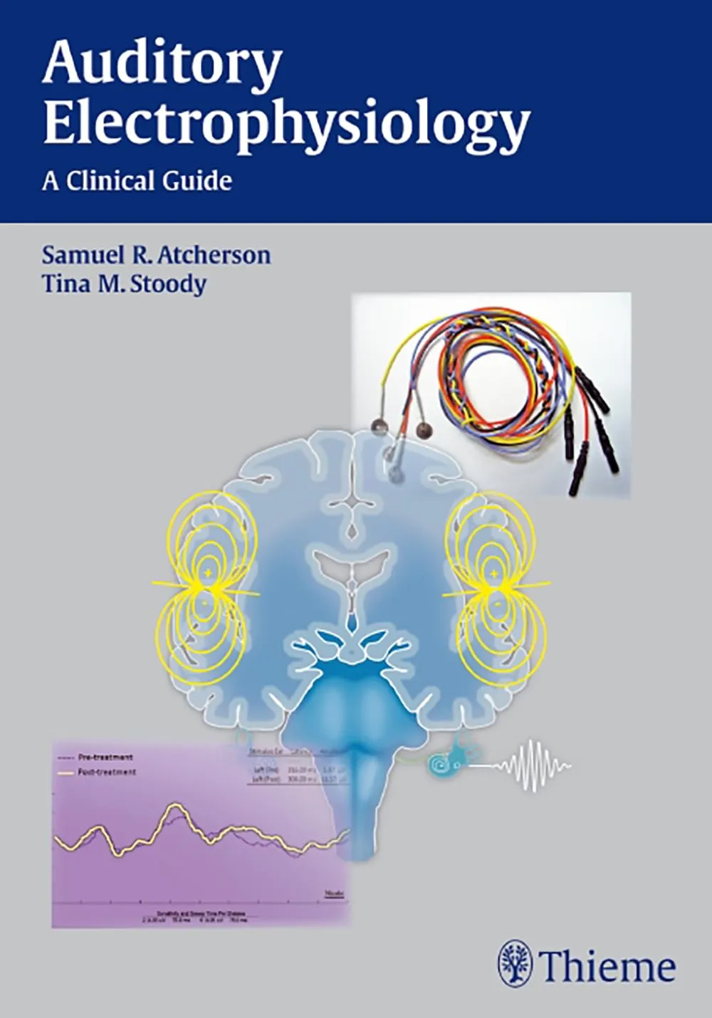 Auditory Electrophysiology A Clinical Guide | Paperback