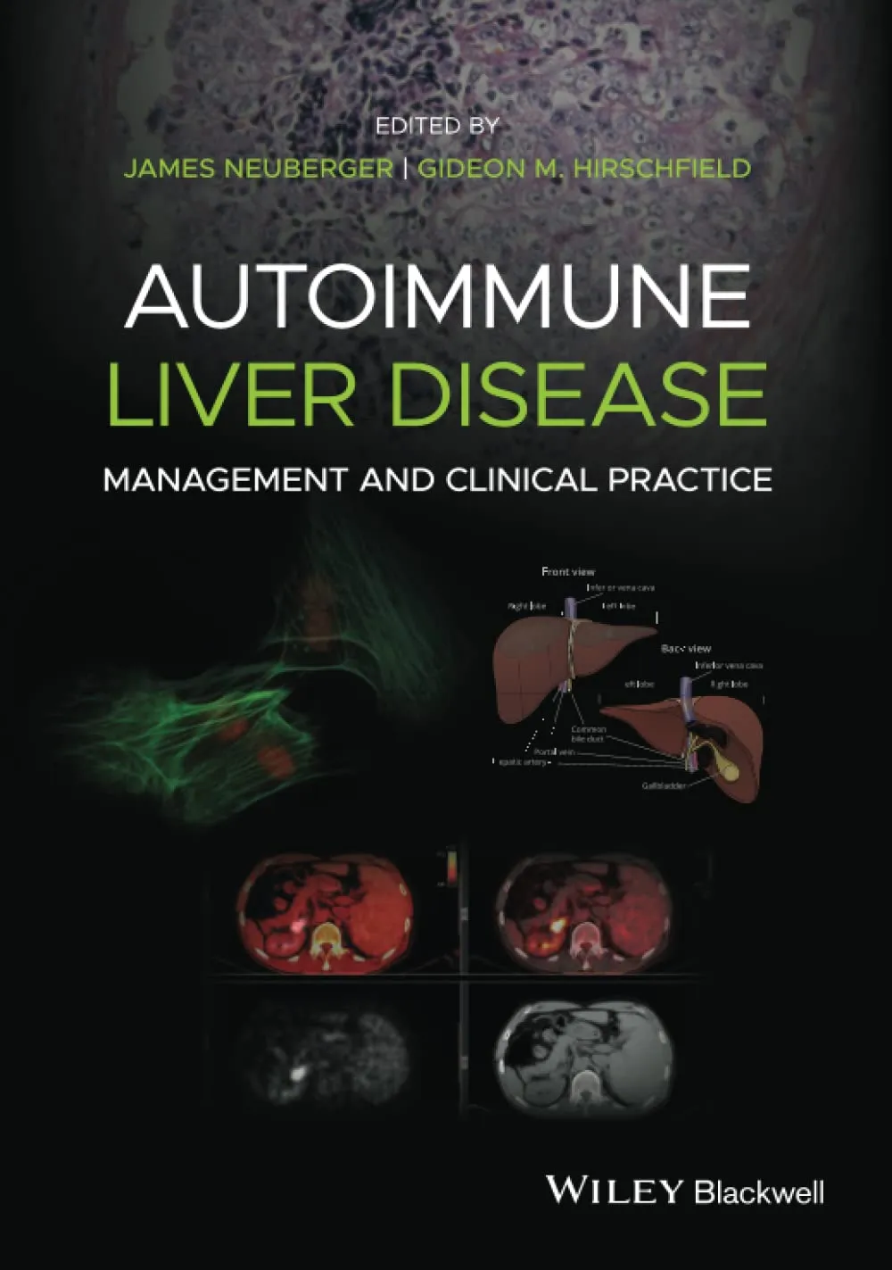 Autoimmune Liver Disease Management And Clinical Practice | Hardcover