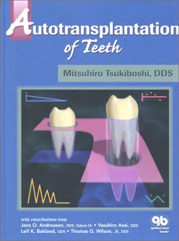 Autotransplantation of Teeth | Hardcover