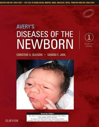 Averys Diseases Of The Newborn (SAE) | Hardcover