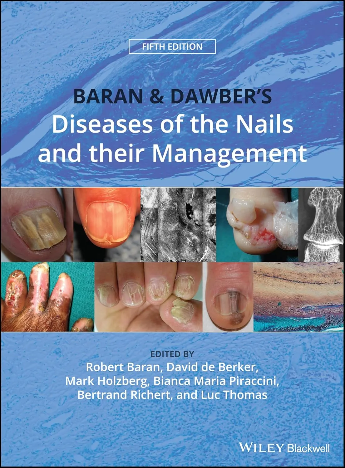 Baran and Dawber's Diseases of the Nails and Their Management | 5th Edition | Hardcover
