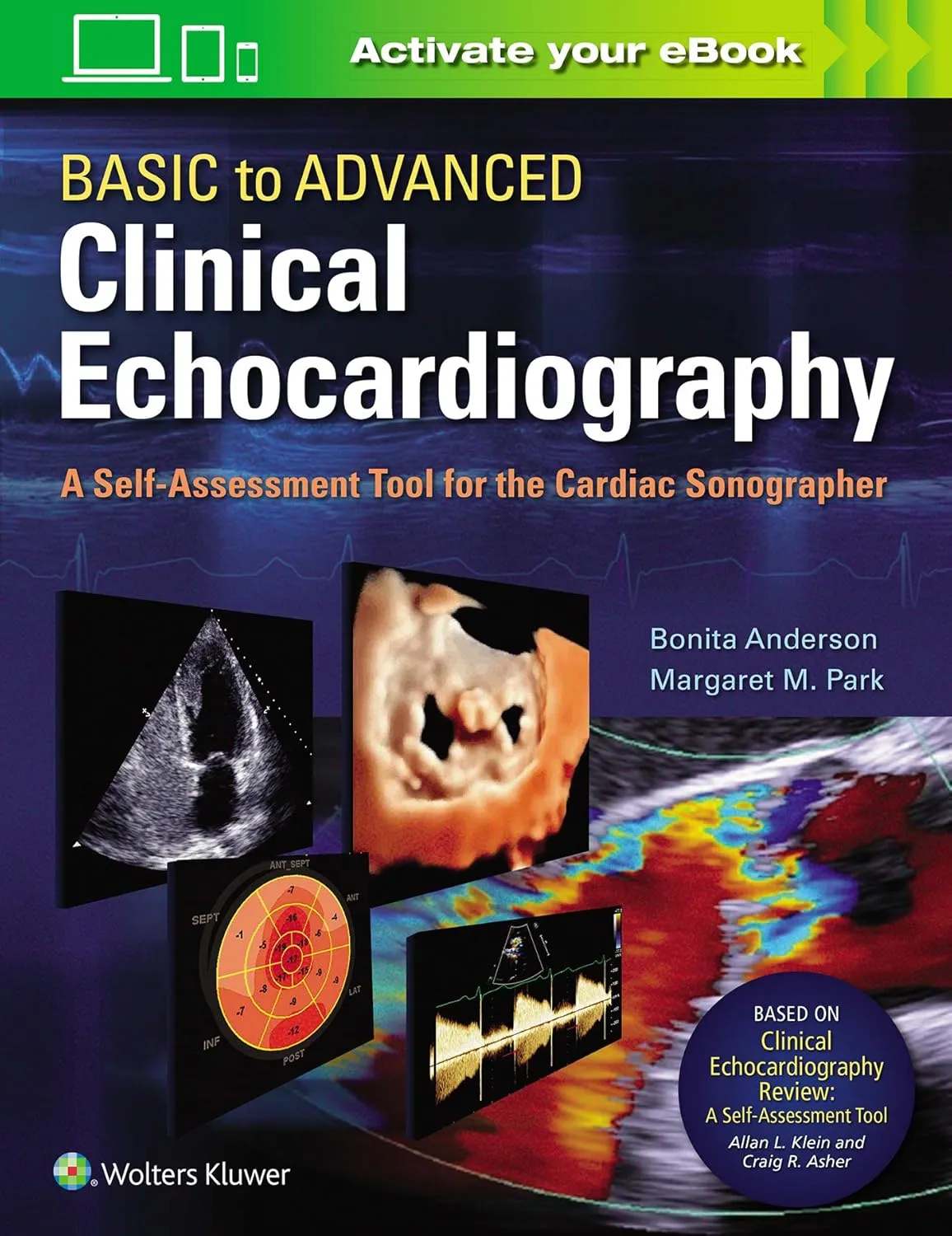 Basic To Advanced Clinical Echocardiography A Self Assessment Tool For The Cardiac Sonographer | Paperback