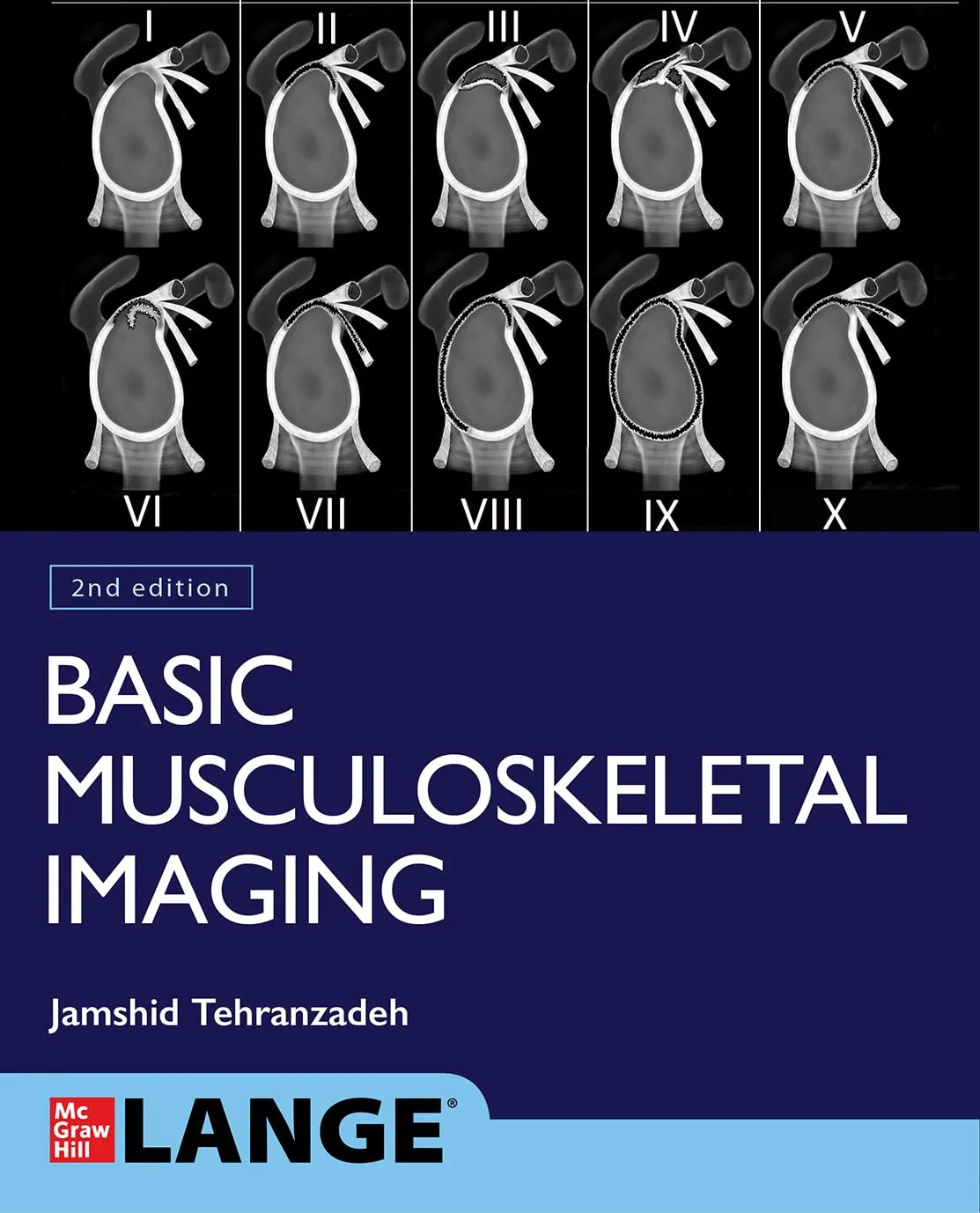 Basic Musculoskeletal Imaging 2nd Edition | Paperback