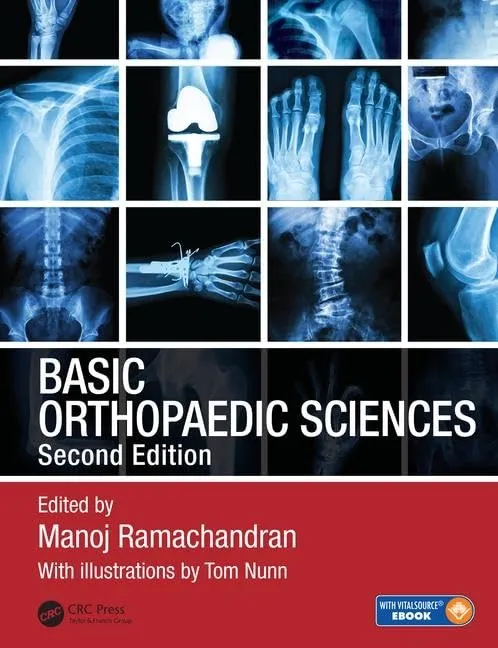 Basic Orthopaedic Sciences | 2nd Edition | Hardcover