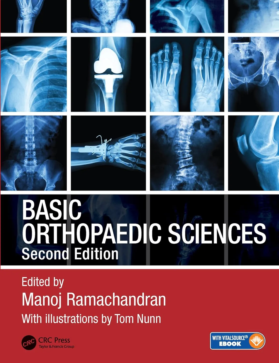 Basic Orthopaedic Sciences | 2nd Edition | Paperback