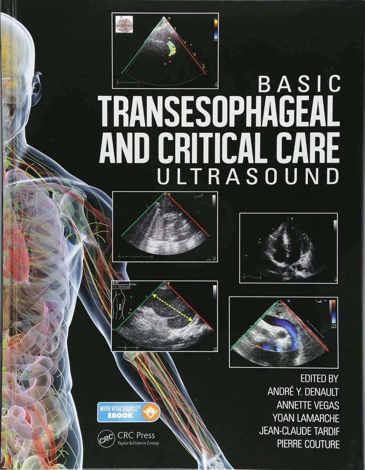 Basic Transesophageal and Critical Care Ultrasound | Hardcover