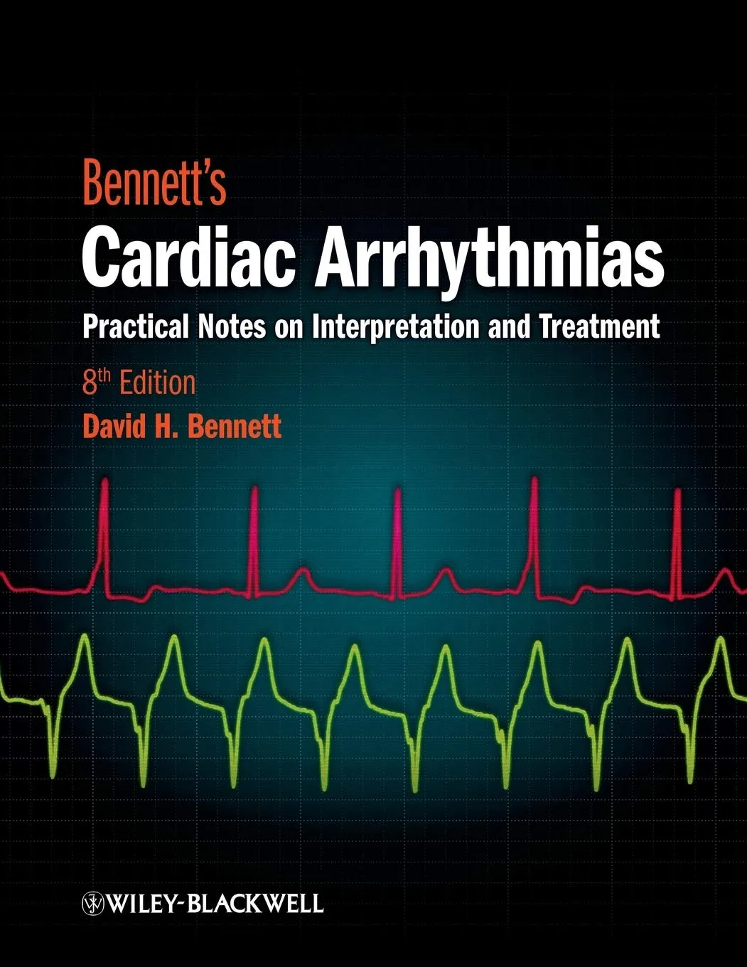 Bennett's Cardiact Arrhythmias Practical Notes on Interpretation and Treatment | Paperback