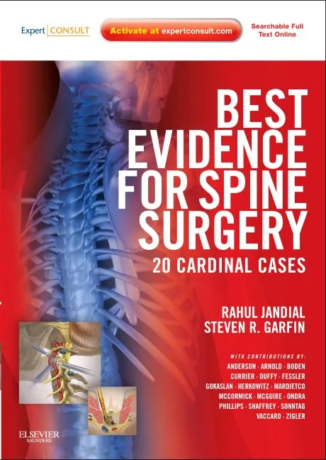 Best Evidence for Spine Surgery 20 Cardinal Cases | Hardcover