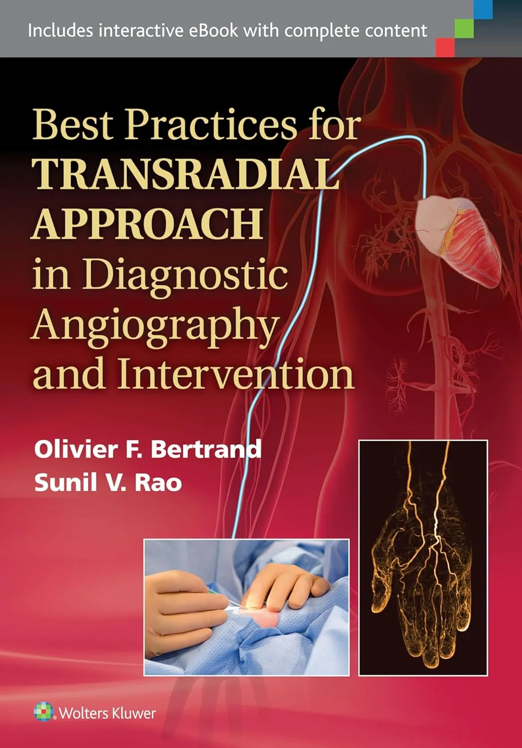 Best Practices for Transradial Approach in Diagnostic Angiography and Intervention | Hardcover