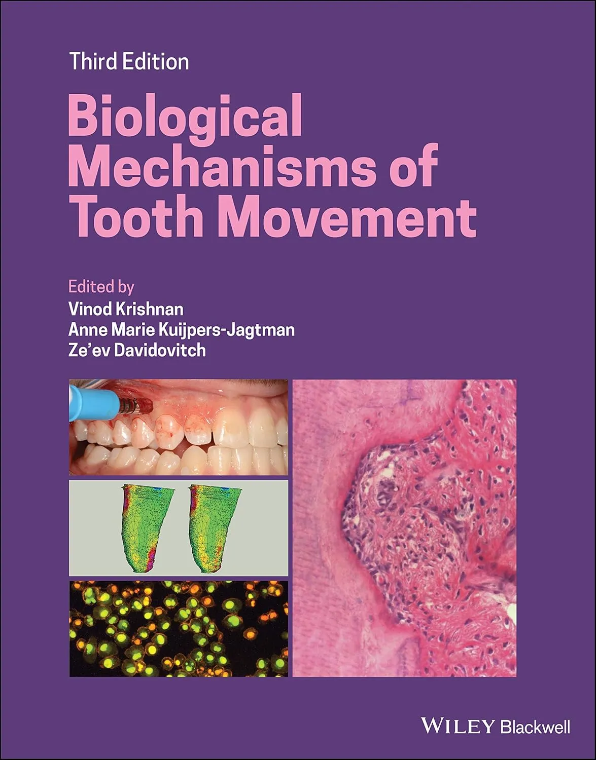 Biological Mechanisms Of Tooth Movement Third Edition | Hardcover