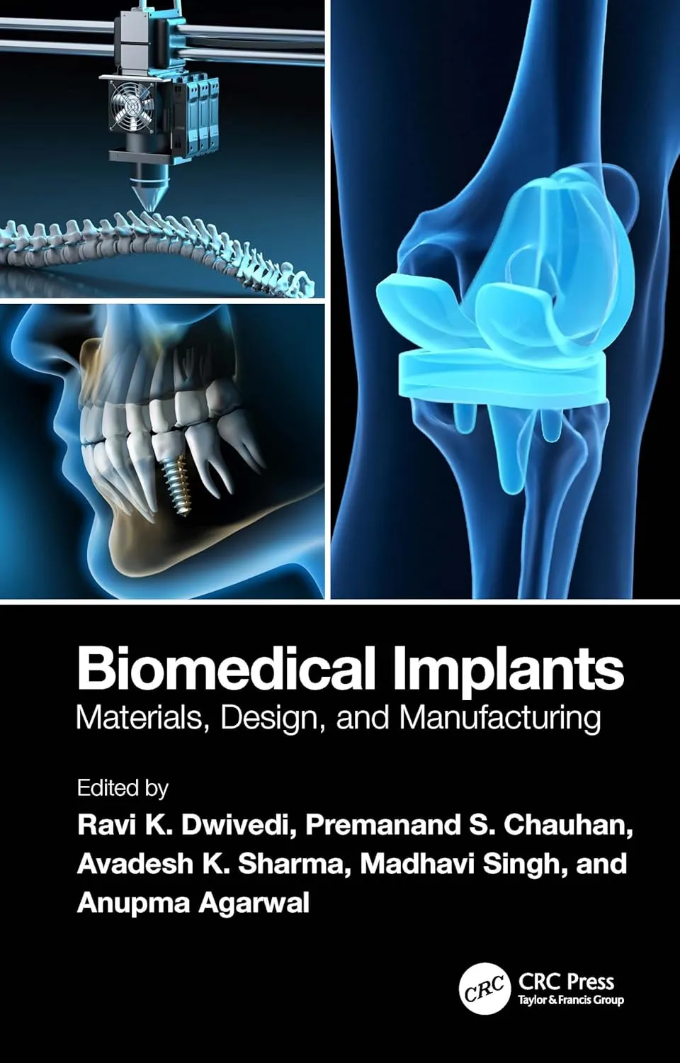 Biomedical Implants Materials Design And Manufacturing | Hardcover