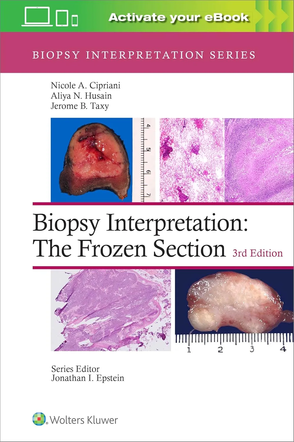 Biopsy Interpretation The Frozen Section Third Edition | Hardcover