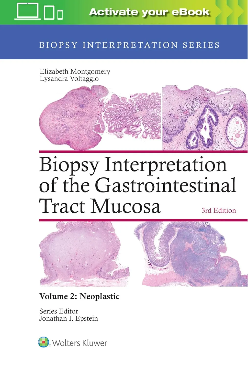 Biopsy Interpretation of the Gastrointestinal Tract Mucosa | Third Edition | Volume 2 Neoplastic | Hardcover