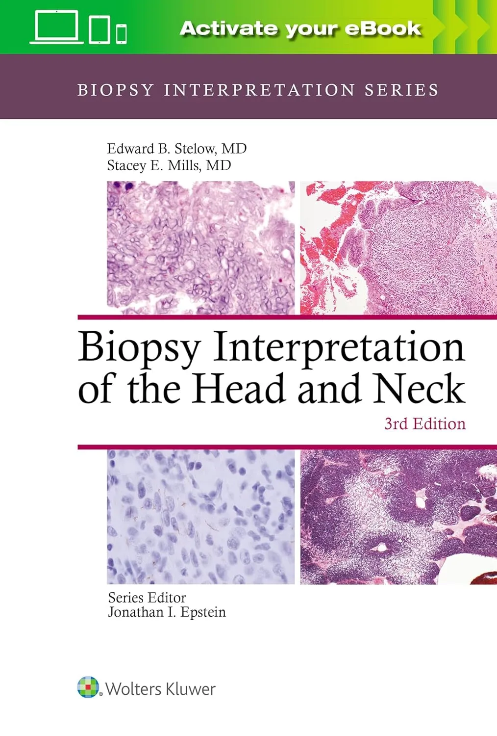 Biopsy Interpretation of The Head and Neck Third Edition | Hardcover