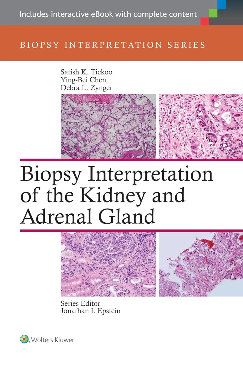 Biopsy Interpretation of the Kidney and Adrenal Gland | Hardcover