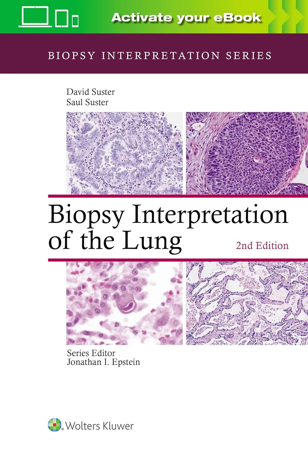 Biopsy Interpretation of The Lung 2nd Edition | Hardcover