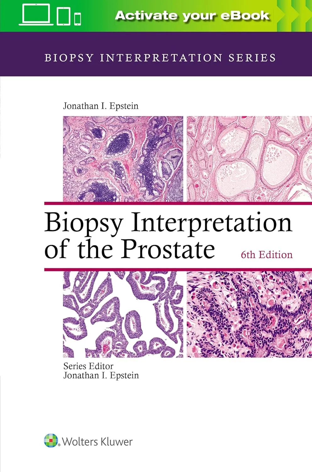 Biopsy Interpretation of the Prostate | 6th Edition | Hardcover
