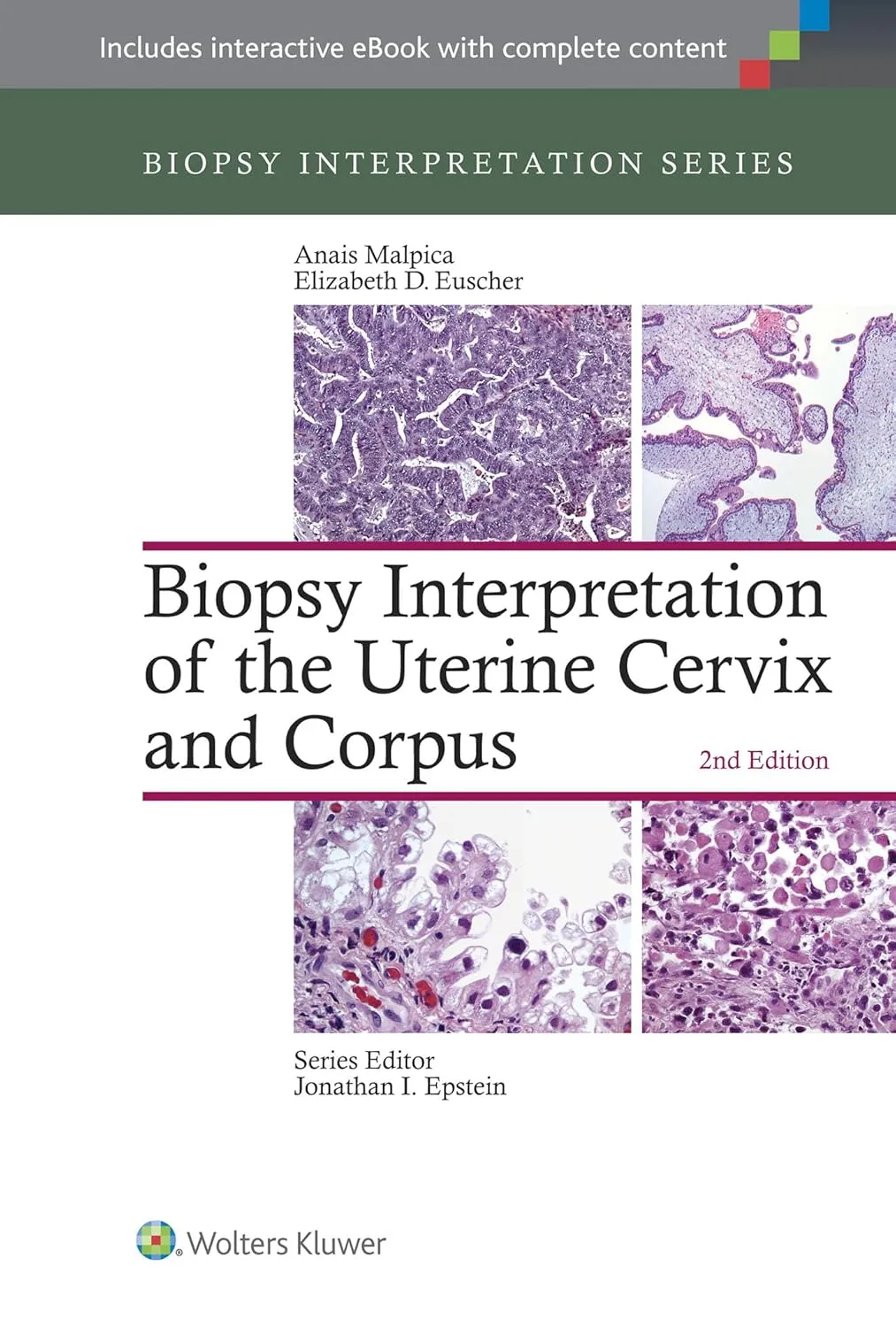 Biopsy Interpretation Series Biopsy Interpretation of the Uterine Cervix and Corpus | 2nd Edition | Hardcover